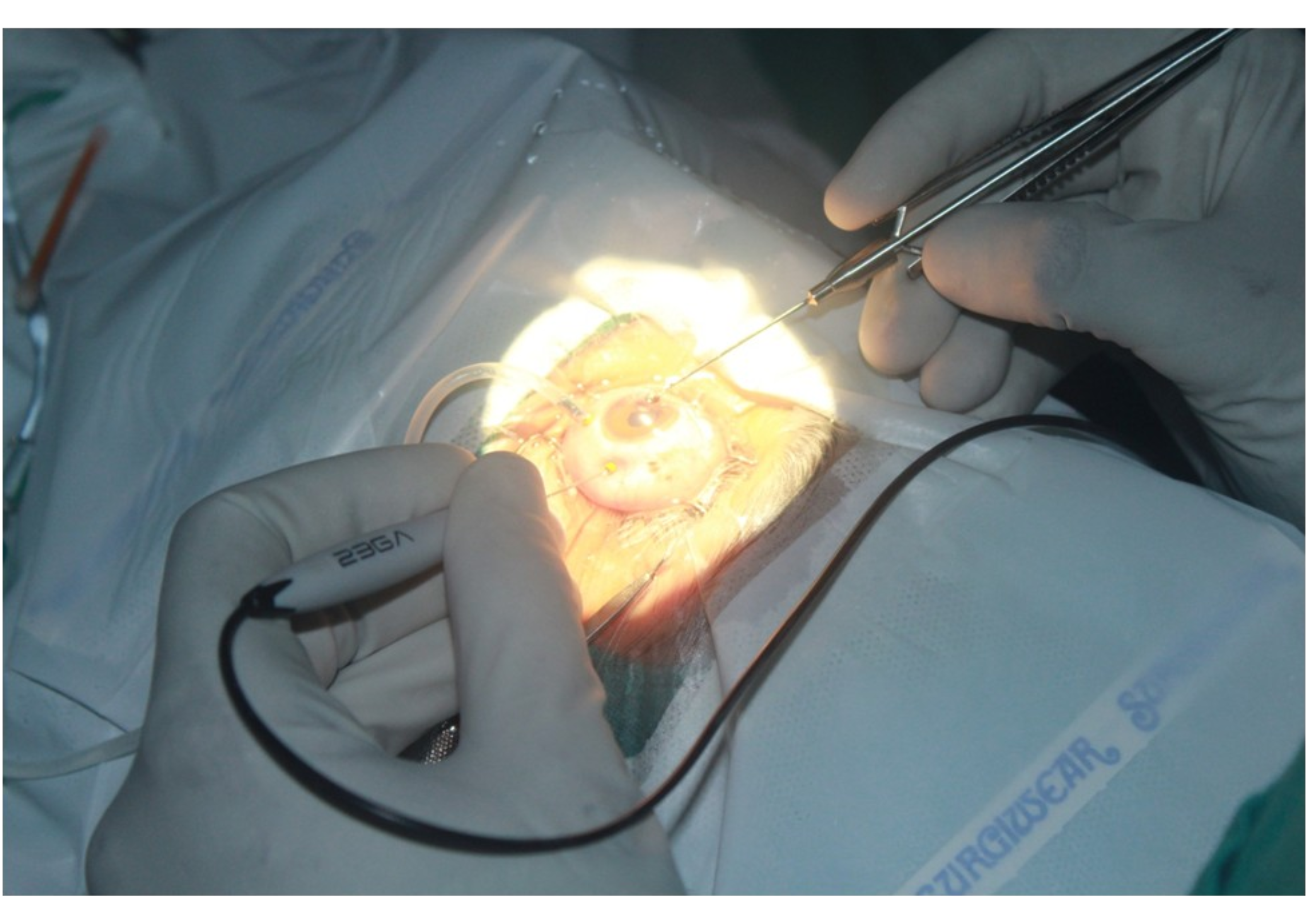 Pellet Surgeries 2016